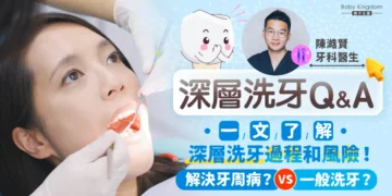 深層洗牙 漂牙 Excelsior Dental Center
